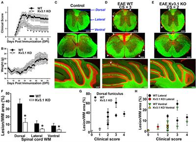 Suppression of Inflammatory Demyelinaton and Axon Degeneration through Inhibiting Kv3 Channels